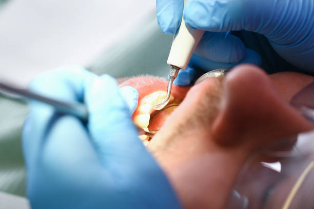 Best Broken or Chipped Tooth Repair in Fishhook, AK