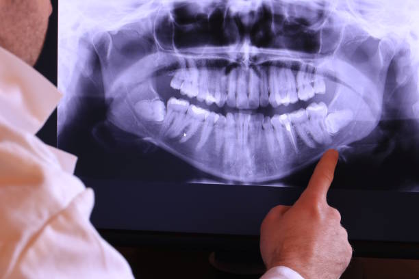 Best Emergency Wisdom Tooth Extraction in Fishhook, AK